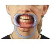 OUVRE BOUCHE PLASTIQUE